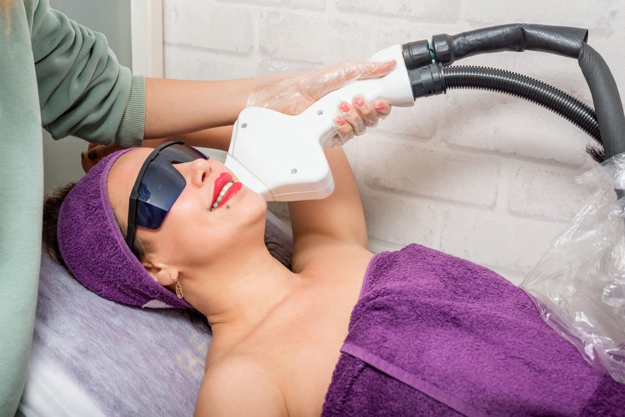 Beytepe Lazer Epilasyon